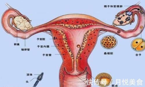 档案|打过胎的女性，会在这3个地方留下痕迹，产科医生一眼就能看穿