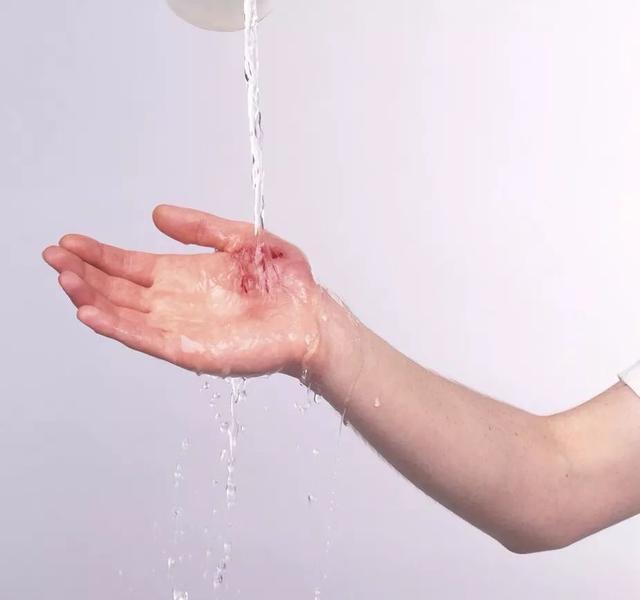 家长|孩子被烫伤后,是先脱衣服还是先冲冷水家长一定要提前知道