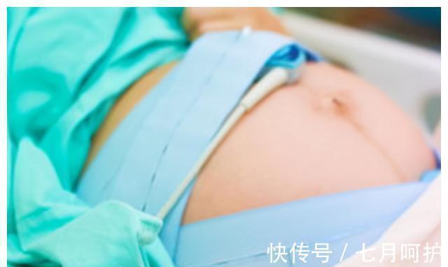 聊天|剖腹产时聊得不亦乐乎,产妇以为医生不走心,结束后才知其用意