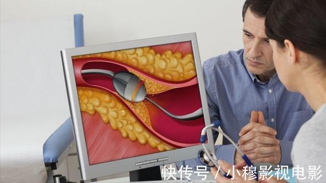 脂肪含量|什么饮食清淡,血脂还是高?提醒:这3个“饮食误区”,别再犯