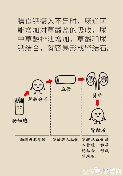 骨量|怕骨折，去补钙，会补出肾结石吗？骨量减少应该这么解决