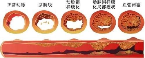 进入老年的你，若还能保持“4个健康”，有长寿