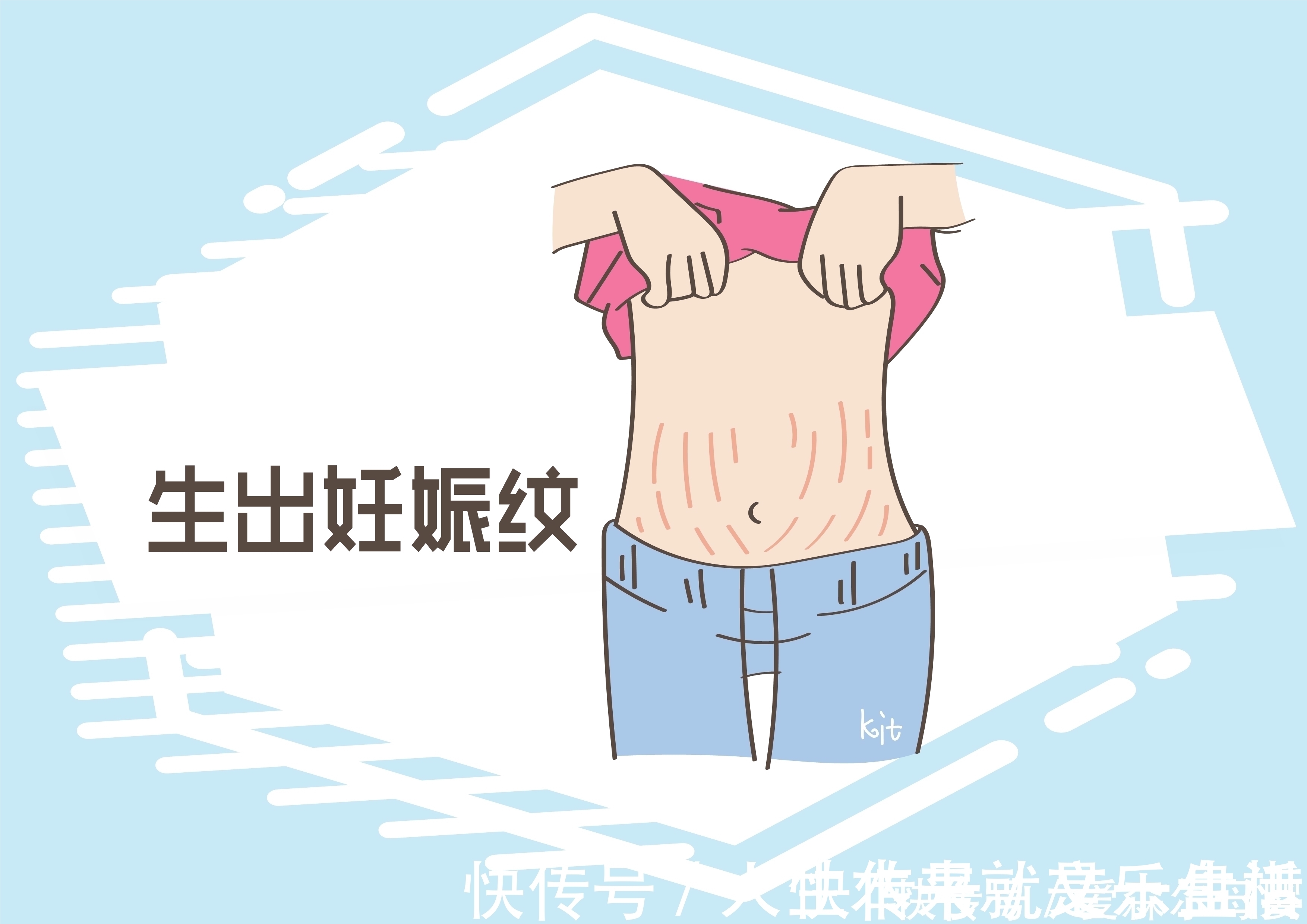 妊娠纹|媳妇自称首次生产,婆婆一眼识破却没明说, 这是为什么?