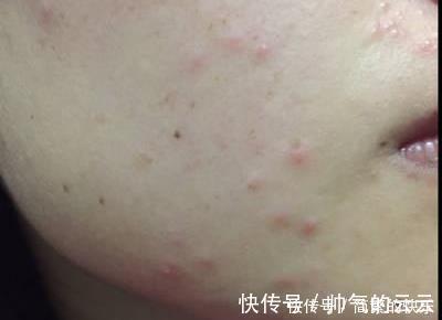 小张|准妈晒怀孕前后对比照,差距大的判若两人,网友没事别随便生娃