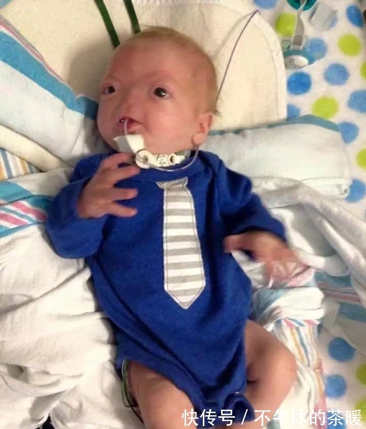 一生|小男孩天生无鼻,却坚持走完了一生