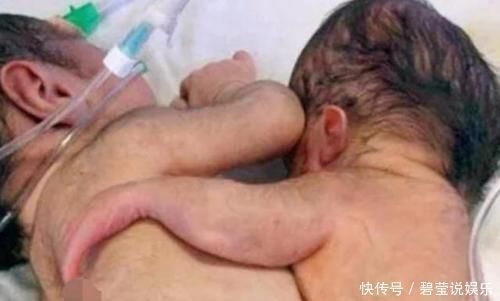 双胞胎|孕妇产检时是双胞胎,孩子出生时,全家人失声痛哭乱作一团