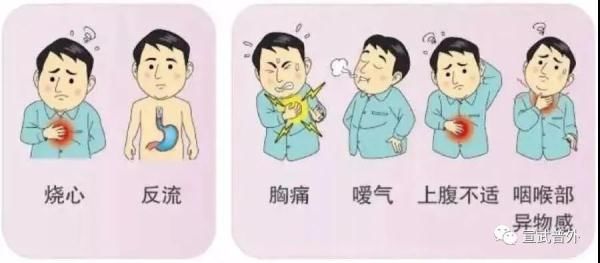 生活方式|胃食管反流病应如何调整生活方式