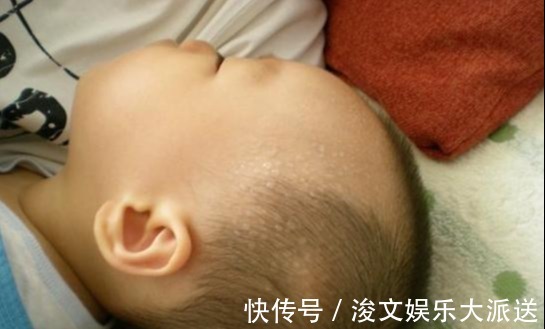 补充水分|宝宝睡觉满头大汗,是热的还是缺钙父母不要忽视出汗几大原因