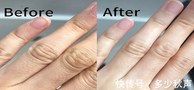 双手|天气一冷,手就容易皱巴巴?教你一招,让双手变得白嫩又光滑