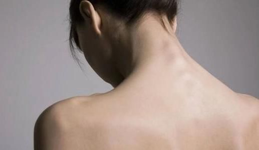 癌症|4个部位长出痣,为健康最好定期检查,以防癌症悄悄接近你