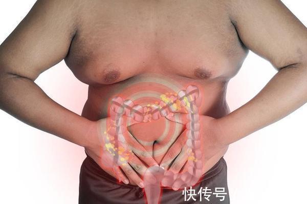 单发性|常见的肠道息肉类型,离不开这6种,但每一种都让人“不省心”