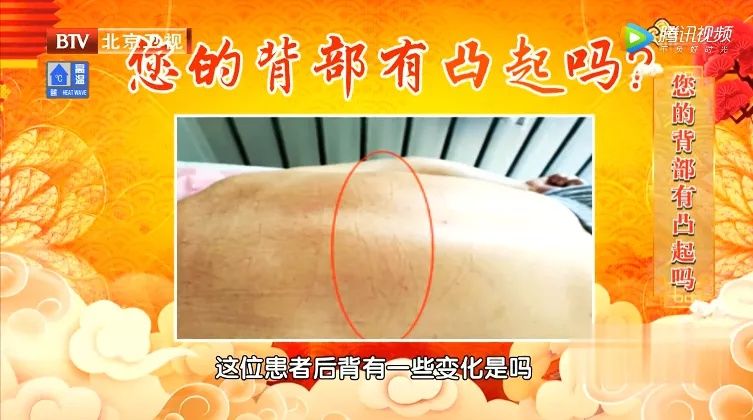 身体这处有凹陷，暗示脾虚了！一个穴位，帮你健脾和胃，补中益气~