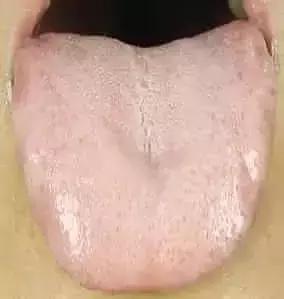 舌诊|中医医生总看舌头都在看什么九种体质+珍贵的舌诊图谱