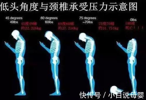 不畅|颈椎疼痛无法忍受?骨科专家教你应对,试试这几个训练吧!