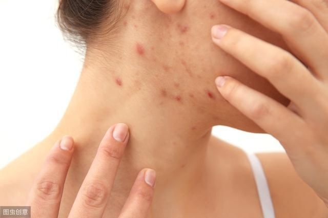 自由基|肝毒太多，身体会有4种表现，若一个也不占，说明肝脏还算健康