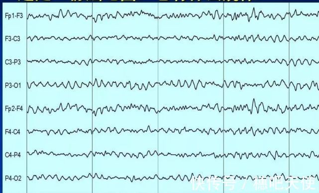 踮脚|当4岁脑瘫男孩,独立迈出人生第一步,全家人心都融化了!
