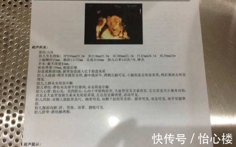 孕囊|B超中若显示这些特点，或许在暗示是一个小公主！