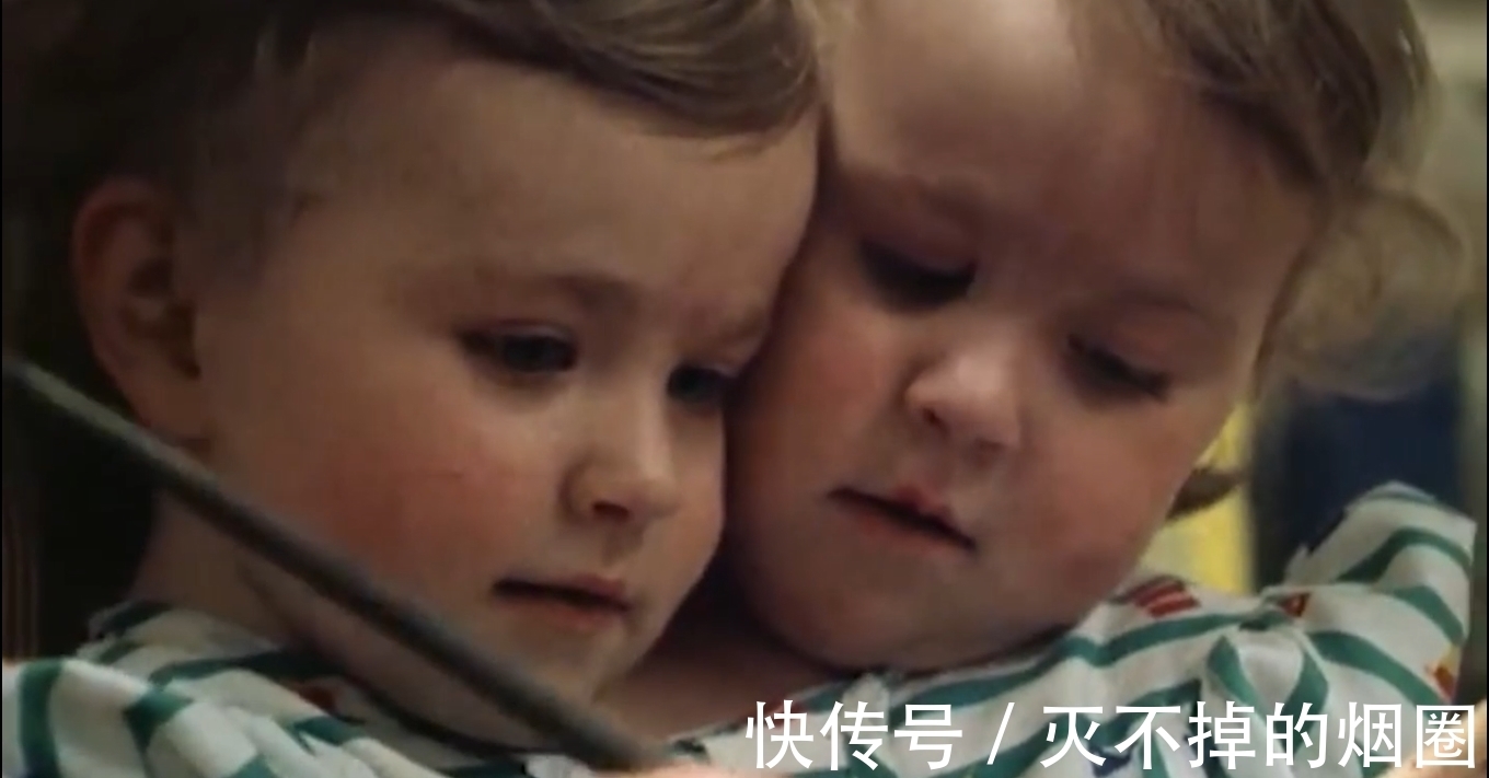 索菲亚|2女孩共用一个躯体生活3年,要将她们个体分离,能成功吗?