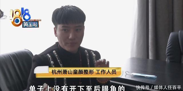 “童颜”做了两个项目,眼角过大额头坑洼