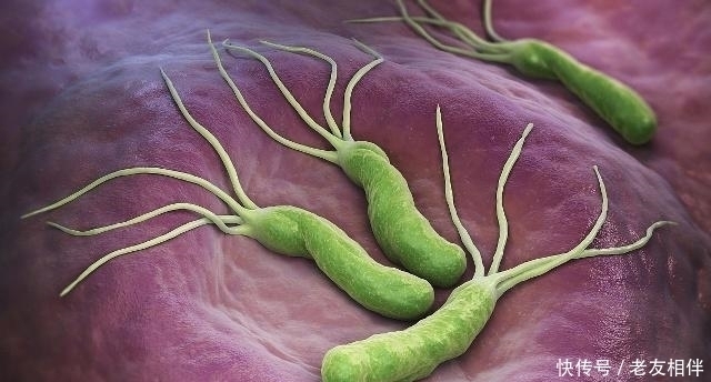 胃中若有幽门螺杆菌,不妨常吃3物,养胃灭菌,
