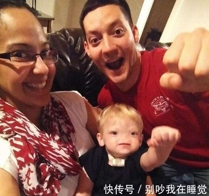 男婴|2岁男婴竟无鼻生活两年,随后发生的事让人落泪