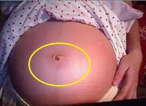 状况|孕妈的肚脐,凸出来好还是凹进去好如果是这种状况说明很有福气