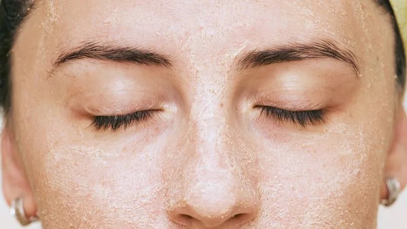 痘痘肌护理的小窍门,爆痘人必看!丨科普篇