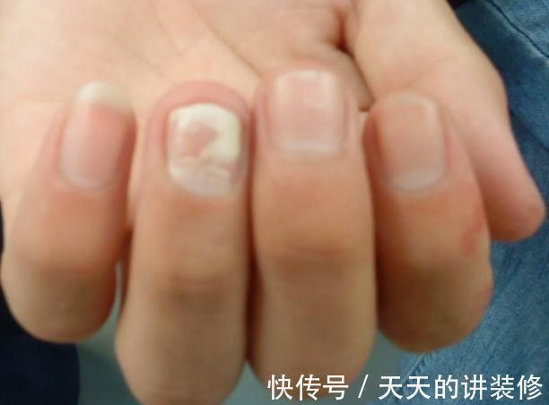 健康状况|寿命短,身体6处可能会发白,若一个不占,提前恭喜,长寿健康