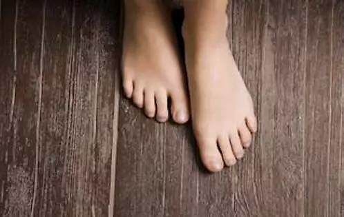 脚毛多怎么去除