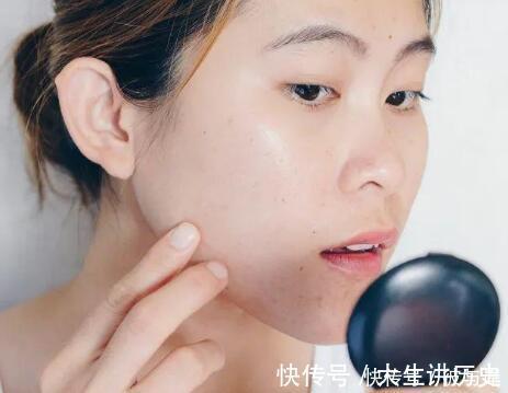 有些人|为什么有些人总会留下痘印？3个祛痘印的方法可以了解一下
