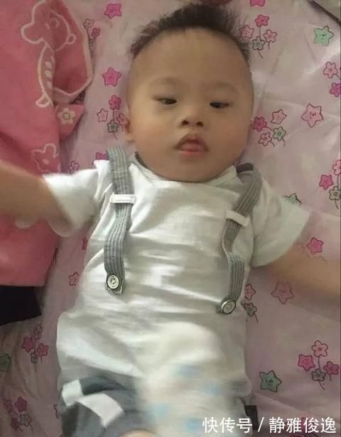 特征|唐氏儿在四维下的特征是什么,自己能不能感觉到胎儿的不正常?