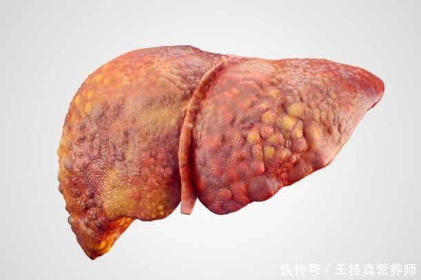 肝损伤|肝损伤不可以吃猪肝?肝不好的人,还要少吃这4种素食