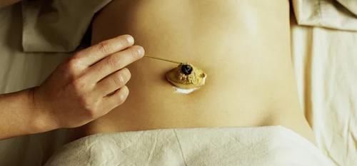 脓性|肚脐眼竟然藏着“生老病死”的秘密!现在知道还不晚,建议收藏!