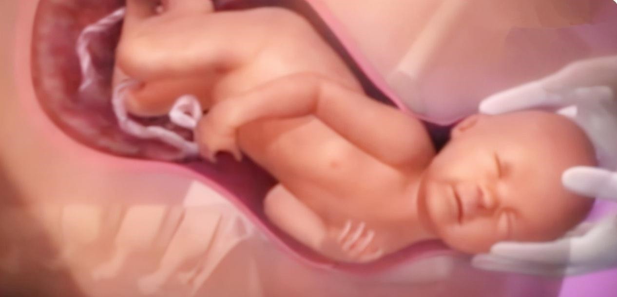 头部|为什么顺产会很痛4张图讲解原因,妈妈没有容易的