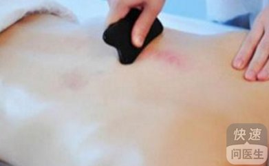 刮痧后头晕恶心的原因到底是哪些？