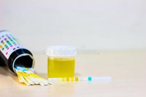 尿路感染|有排尿不尽感？可能是血糖高了，5个信号暗示你的血糖已超标