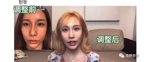 这些变化代表你老了!韩国女生最怕的5个老化现象