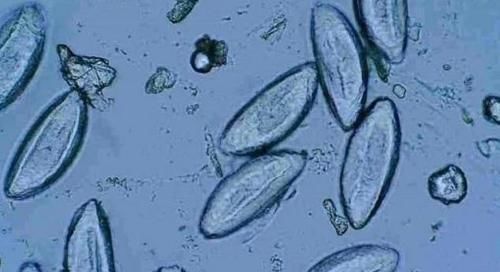 男孩|5岁男孩哭闹说“屁屁痒”,宝妈脱下裤子后吓晕,发现有什么在动