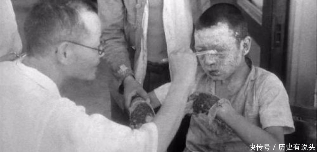 爆炸|日本原子弹爆炸后，6岁男孩背弟弟遗体去火葬场，后来过得怎样？