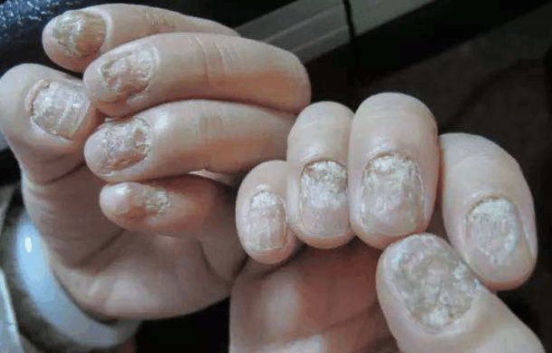 退休|退休医生坦白说去医院治这10种病，都是浪费钱！你被坑了多少