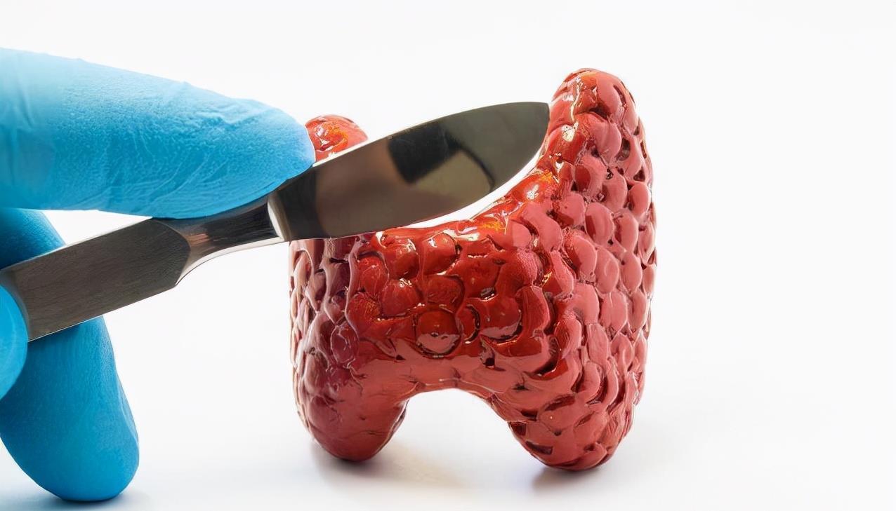 甲状腺结节|甲状腺有结节的人，水果不能随便吃，尤其是这4种建议尽量少碰