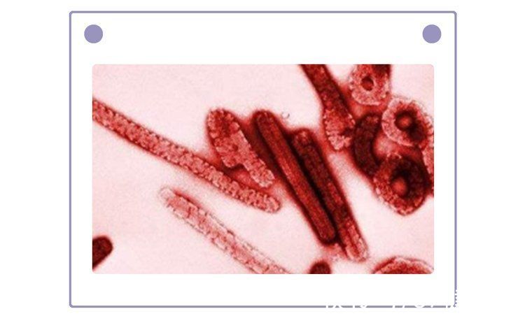 埃博拉：世上最高级别的病毒之一，每隔几年爆发一次，有多可怕？