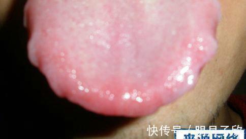 脾脏|湿气的“七寸”在哪里?你抓对了吗?湿重,少做3事,贵在坚持