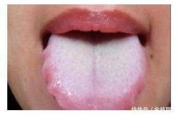 阴陵泉|“湿气重，百病生”，常按3个祛湿穴，轻松排除湿又减肥！