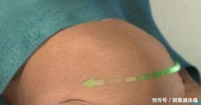 顺产|顺产妈妈分娩后腹部还会有个鼓鼓的硬块是怎么回事