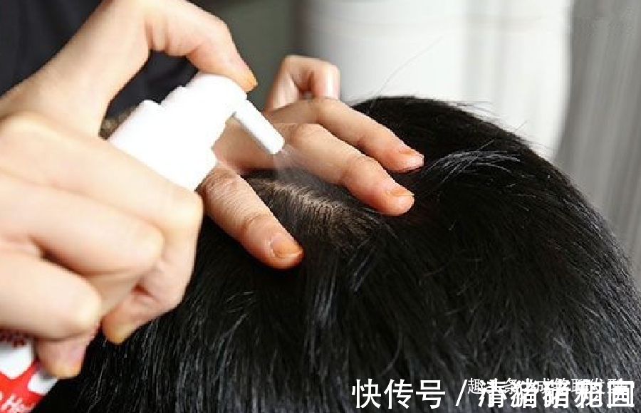 染发 白发多也不要频繁染发,伤发又上头皮,这四个小妙招解决白发困扰