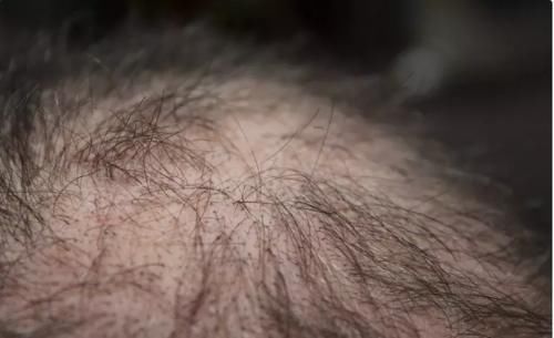 养发|头发长吸血吸营养,真的有道理?中医为你科学解答头发的奥秘