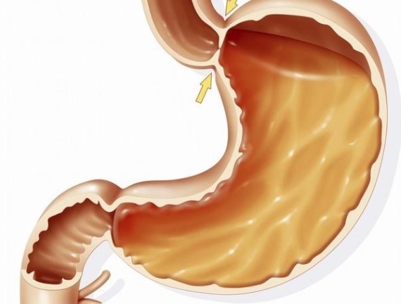 健康|浅表性胃炎经常不舒服,医生说不用吃药,养胃做好5点很关键