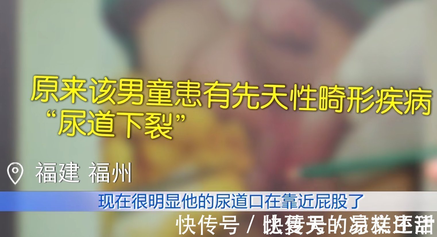 残疾人|女童被养到三岁大,到医院一查是个“纯爷们”,医生也是头一次见