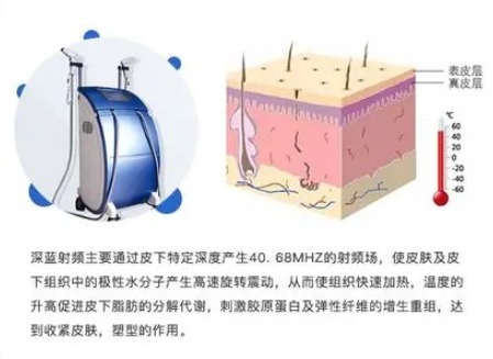 光子嫩肤 深蓝射频做一次有效果吗？和光子嫩肤哪个好？功效、适应症盘点！